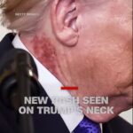 Tình trạng sa sút của Donald Trump