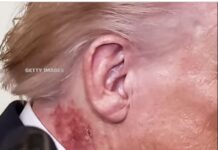 Tình trạng sa sút của Donald Trump