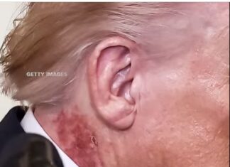 Tình trạng sa sút của Donald Trump