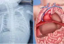 Đạo đức đang “chết não”